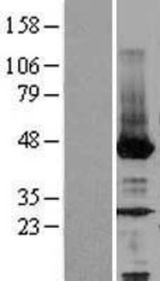 Western Blot: NEU2 Overexpression Lysate (Adult Normal) [NBL1-13595] Left-Empty vector transfected control cell lysate (HEK293 cell lysate); Right -Over-expression Lysate for NEU2.