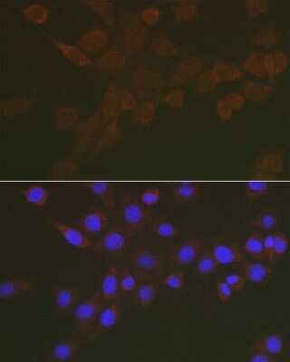 Immunocytochemistry/ Immunofluorescence NEU3 Antibody - Azide and BSA Free