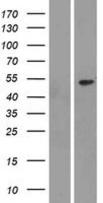 Western Blot: NEU3 Overexpression Lysate (Adult Normal) [NBP2-04315] Left-Empty vector transfected control cell lysate (HEK293 cell lysate); Right -Over-expression Lysate for NEU3.