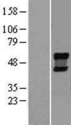 Western Blot: NEU4 Overexpression Lysate (Adult Normal) [NBL1-13597] Left-Empty vector transfected control cell lysate (HEK293 cell lysate); Right -Over-expression Lysate for NEU4.