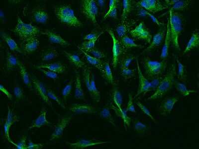 Immunocytochemistry/Immunofluorescence: NEURL Antibody [NBP2-99299] - Immunofluorescence staining of NEURL in U251MG cells. Cells were fixed with 4% PFA, permeabilzed with 0.1% Triton X-100 in PBS, blocked with 10% serum, and incubated with rabbit anti-Human NEURL polyclonal antibody (dilution ratio 1:1000) at 4C overnight. Then cells were stained with the Alexa Fluor(R)488-conjugated Goat Anti-rabbit IgG secondary antibody (green) and counterstained with DAPI (blue).Positive staining was localized to Cytoplasm.