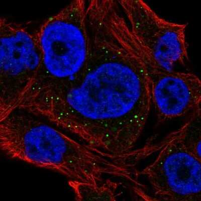 Immunocytochemistry/Immunofluorescence: NEURL2 Antibody [NBP2-56809] - Staining of human cell line SK-MEL-30 shows localization to vesicles.