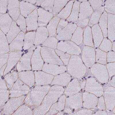 Immunohistochemistry-Paraffin: NEURL2 Antibody [NBP2-13654] - Staining of human skeletal muscle shows moderate cytoplasmic positivity in myocytes.