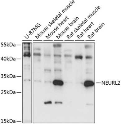 Western Blot: NEURL2 Antibody [NBP2-94337] - Analysis of extracts of various cell lines, using NEURL2 at 1:1000 dilution.Secondary antibody: HRP Goat Anti-Rabbit IgG (H+L) at 1:10000 dilution.Lysates/proteins: 25ug per lane.Blocking buffer: 3% nonfat dry milk in TBST.Detection: ECL Basic Kit .Exposure time: 15s.