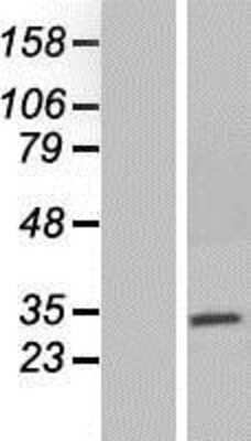 Western Blot: NEURL2 Overexpression Lysate (Adult Normal) [NBP2-05762] Left-Empty vector transfected control cell lysate (HEK293 cell lysate); Right -Over-expression Lysate for NEURL2.