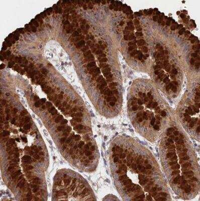 Immunohistochemistry-Paraffin: NEURL4 Antibody [NBP1-93574] - Staining of human stomach shows strong cytoplasmic positivity in glandular cells.