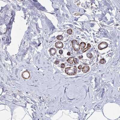 Immunohistochemistry-Paraffin: NEURL4 Antibody [NBP2-33748] - Staining of human breast shows strong cytoplasmic positivity in myoepithelial cells.