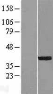 Western Blot: NEUROD4 Overexpression Lysate (Adult Normal) [NBL1-13600] Left-Empty vector transfected control cell lysate (HEK293 cell lysate); Right -Over-expression Lysate for NEUROD4.