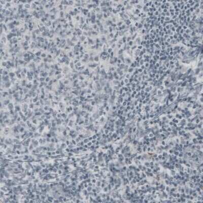 Immunohistochemistry: NF-H Antibody (2671) [NBP2-46615] - Staining of human tonsil shows absence of immunoreactivity (negative control).