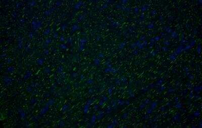 Immunohistochemistry-Frozen: NF-H Antibody [NB300-217] - Canine optic nerve, antibody specifically labelled the axons (Green).  Blue is DAPI.  Image taken with an epifluorescent microscope and was incubated at 1:10000 for 1hr at RT..  Image from verified customer review. 