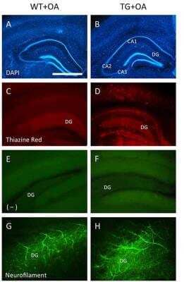 Immunohistochemistry: NF-H Antibody [NB300-135] - Immunostainings of adult organotypic brain slices at the hippocampal level. Brain slices were prepared from WT or TG adult mice and incubated with okadaic acid (OA). Brain slices were stained for nuclear DAPI (blue, A,B) showing intact brain structures. Thiazine Red staining (C,D) shows red fluorescent plaques in the hippocampus (D) of TG mice, while only background is seen in the hippocampus (C) of WT mice. Staining of neurofilament fibers (G,H) shows good neuronal viability both in WT and TG mice. Image collected and cropped by CiteAb from the following publication (//journal.frontiersin.org/article/10.3389/fnagi.2018.00113/full) licensed under a CC-BY license.