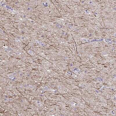 Immunohistochemistry-Paraffin: NF-H Antibody [NBP2-37984] - Staining of human cerebral cortex shows strong membranous positivity in neuropil.