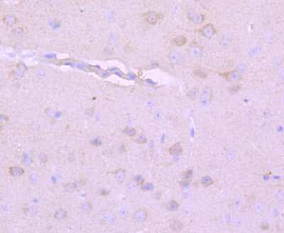 Immunohistochemistry-Paraffin: NF-H Antibody (JF99-07) [NBP2-66975] - Analysis of paraffin-embedded mouse brain tissue using anti-NEFH antibody. Counter stained with hematoxylin.