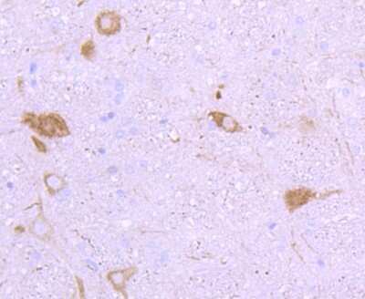 Immunohistochemistry-Paraffin: NF-H Antibody (JF99-07) [NBP2-66975] - Analysis of paraffin-embedded rat cerebellum tissue using anti-NEFH antibody. Counter stained with hematoxylin.