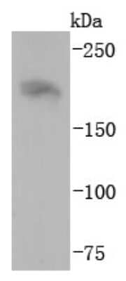 Western Blot: NF-H Antibody (JF99-07) [NBP2-66975] - Analysis of NEFH on mouse brain lysates using anti-NEFH antibody at 1/1,000 dilution.