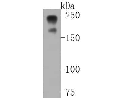 Western Blot: NF-H Antibody (JF99-07) [NBP2-66975] - Western blot analysis of NF-H on rat brain tissue lysates. Proteins were transferred to a PVDF membrane and blocked with 5% BSA in PBS for 1 hour at room temperature. The primary antibody (1/500) was used in 5% BSA at room temperature for 2 hours. Goat Anti-Rabbit IgG - HRP Secondary Antibody (HA1001) at 1:5,000 dilution was used for 1 hour at room temperature.