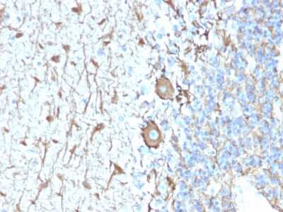 Immunohistochemistry-Paraffin: NF-H Antibody (NEFL.H/2324R) - Azide and BSA Free [NBP3-08552] - Formalin-fixed, paraffin-embedded human Cerebellum stained with NF-H Rabbit Recombinant Monoclonal Antibody (NEFL.H/2324R).