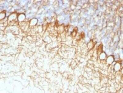 Immunohistochemistry-Paraffin: NF-H Antibody (NF421) - Azide and BSA Free [NBP2-33102] - Formalin-fixed, paraffin-embedded Rat Cerebellum stained with Neurofilament Monoclonal Antibody (RT-91).