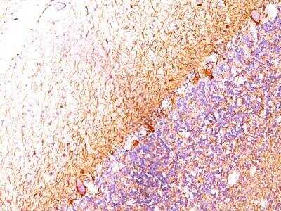 Immunohistochemistry-Paraffin: NF-H Antibody (RT-97 + NR-4) - Azide and BSA Free [NBP2-47664] - Human Cerebellum stained with Neurofilament Monoclonal Antibody (RT-97 + NR-4).
