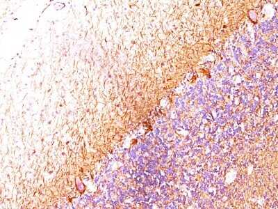 Immunohistochemistry-Paraffin: NF-H Antibody (RT-97 + NR-4) [NBP2-45280] - Human Cerebellum stained with Neurofilament Monoclonal Antibody (RT-97 + NR-4).