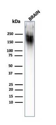 Western Blot: NF-H Antibody (SPM203) - Azide and BSA Free [NBP2-47833] - Western Blot Analysis of Human Brain tissue lysate using NF-H MAb (SPM203).