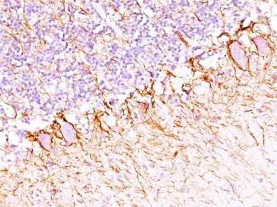 Immunohistochemistry-Paraffin: NF-H Antibody (SPM203) [NBP2-44727] - Human Cerebellum stained with Neurofilament Monoclonal Antibody (SPM203).