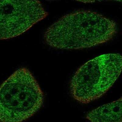 Immunocytochemistry/Immunofluorescence: NF-L Antibody [NBP2-58699] - Staining of human cell line PC-3 shows localization to nuclear speckles & intermediate filaments.