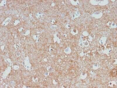 Immunohistochemistry-Paraffin: NF-L Antibody (NEFL/2983R) [NBP3-07407] - Formalin-fixed, paraffin-embedded human Cerebellum stained with NF-L Rabbit Monoclonal Antibody (NEFL/2983R).