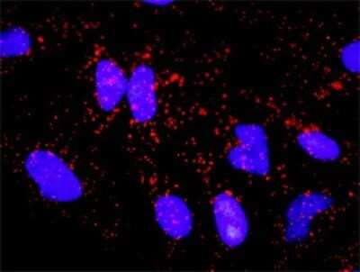 Proximity Ligation Assay: NF-L Antibody [H00004747-D01P] - Analysis of protein-protein interactions between NEFL and APP. HeLa cells were stained with anti-NEFL rabbit purified polyclonal 1:1200 and anti-APP mouse monoclonal antibody 1:50. Each red dot represents the detection of protein-protein interaction complex, and nuclei were counterstained with DAPI (blue).