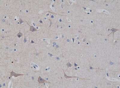 Immunohistochemistry-Paraffin: NF-L Antibody (RM280) [NBP2-61569] - Immunohistochemical staining of formalin fixed and paraffin embedded Human brain tissue sections using NBP2-61569.