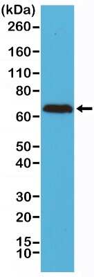 Western Blot: NF-L Antibody (RM280) [NBP2-61569] - Western Blot of Human brain tissue lysates using NBP2-61569.