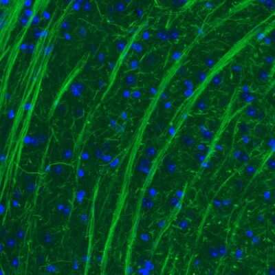 Immunohistochemistry: NF-M Antibody (2688) [NBP2-46618] - Staining of mouse thalamus shows strong positivity in neural fibers.