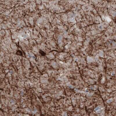 Immunohistochemistry: NF-M Antibody (2688) [NBP2-46618] - Staining of human cerebral cortex shows strong positivity in neural fibers and cell bodies.