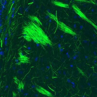 Immunohistochemistry: NF-M Antibody (2697) [NBP2-46619] - Staining of rat striatum shows strong positivity in neural fibers.