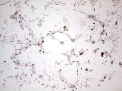 Immunohistochemistry: NF-M Antibody (2G3) [NBP2-46139] - Analysis of Human skin tissue. (Heat-induced epitope retrieval by 1 mM EDTA in 10mM Tris, pH8.5, 120C for 3min)