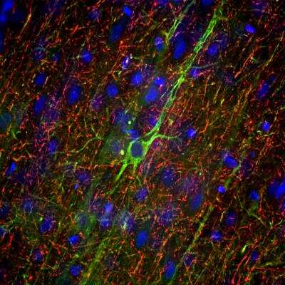 Immunohistochemistry Free-Floating: NF-M Antibody (3H11) [NB300-134] - Adult rat frontal cortex section stained with mouse mAb to neurofilament NF-M, dilution 1:5,000 in green, and costained with chicken pAb to neurofilament NF-H, dilution 1:5,000 in red. Following transcardial perfusion of rat with 4% paraformaldehyde, brain was post fixed for 24 hours, cut to 45uM, and free-floating sections were stained with above antibodies. NB300-134 antibody labels neuron cell bodies and dendrites of pyramidal neurons, as well as dendrites and axons of other neuronal cells, while the NF-H antibody stains the network of neuronal axons only.