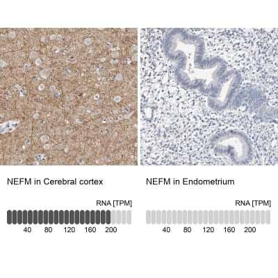 Immunohistochemistry-Paraffin: NF-M Antibody [NBP1-87753] - Analysis in human cerebral cortex and endometrium tissues using NBP1-87753 antibody. Corresponding NEFM RNA-seq data are presented for the same tissues.