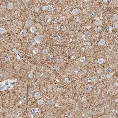 Immunohistochemistry-Paraffin: NF-M Antibody [NBP1-87753] - Staining of human cerebral cortex shows strong positivity in neuronal processes.