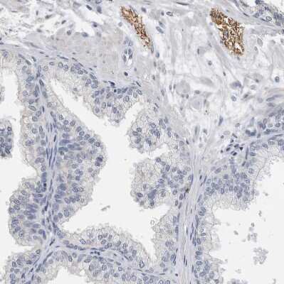 Immunohistochemistry-Paraffin: NF-M Antibody [NBP1-87753] - Staining of human prostate shows strong positivity in peripheral nerve.