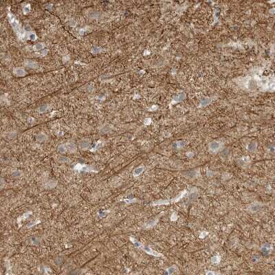 Immunohistochemistry-Paraffin: NF-M Antibody [NBP1-87754] - Staining of human cerebral cortex shows strong cytoplasmic positivity in neurons.