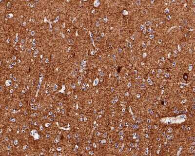 Immunohistochemistry-Paraffin: NF-M Antibody (JM11-20) [NBP2-66978] - Analysis of paraffin-embedded human brain tissue with Rabbit anti-NF-M antibody washed with ddH2O and PBS, and then probed with the primary antibody  at 1/400 dilution for 1 hour at room temperature. The detection was performed using an HRP conjugated compact polymer system. DAB was used as the chromogen. Tissues were counterstained with hematoxylin and mounted with DPX.