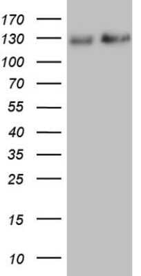 Western Blot: NF-M Antibody (OTI2G3) - Azide and BSA Free [NBP2-72977] - Analysis of HEK293T cells were transfected with the pCMV6-ENTRY control (Left lane) or pCMV6-ENTRY NF-M.