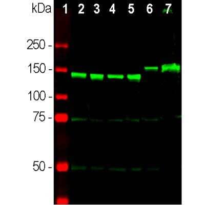 Western Blot: NF-M Antibody [NB300-133] - Analysis of neuronal tissue lysates using rabbit pAb to NF-M, NB300-133, dilution 1:2,000 in green: [1] protein standard (red), [2] rat brain, [3] rat spinal cord, [4] mouse brain, [5] mouse spinal cord, [6] pig brain, [7] pig spinal cord. Strong bands at 145kDa correspond to rodent NF-M molecules, while the NF-M of pig and other larger mammals including humans run at about 160kDa.