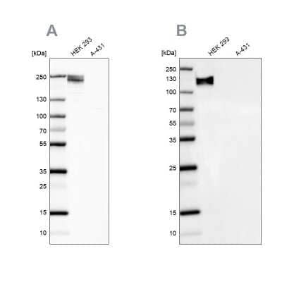 <b>Independent Antibodies Validation. </b>Western Blot: NF-M Antibody [NBP1-87753] - Analysis NBP1-87753 (A) shows similar pattern to independent antibody NBP1-87754 (B).