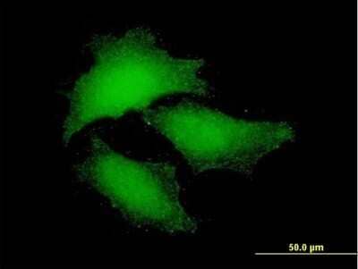 Immunocytochemistry/Immunofluorescence: NF2/Merlin Antibody [H00004771-B02P] - Analysis of purified antibody to NF2 on HeLa cell. (antibody concentration 10 ug/ml)