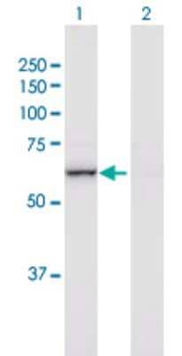 Western Blot: NF2/Merlin Antibody [H00004771-B02P] - Analysis of NF2 expression in transfected 293T cell line by NF2 polyclonal antibody.  Lane 1: NF2 transfected lysate(55.77 KDa). Lane 2: Non-transfected lysate.