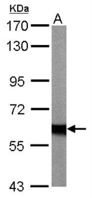 Western Blot: NF2/Merlin Antibody [NBP1-33531] - Sample (20 ug of whole cell lysate)  A: mouse brain  7.5% SDS PAGE   diluted at 1:10000