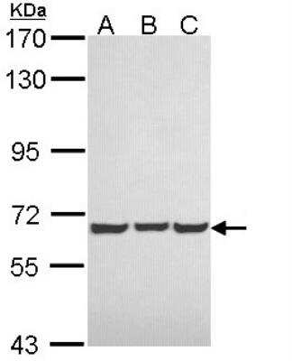 Western Blot: NF2/Merlin Antibody [NBP1-33531] - Sample (30 ug of whole cell lysate)  A: A431 B: H1299 C: Hela 7.5% SDS PAGE diluted at 1:1000