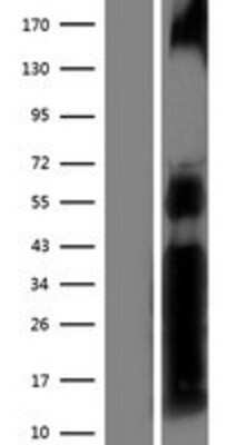 Western Blot NFATC2/NFAT1 Overexpression Lysate