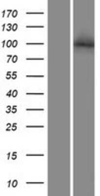 Western Blot NFATC2/NFAT1 Overexpression Lysate